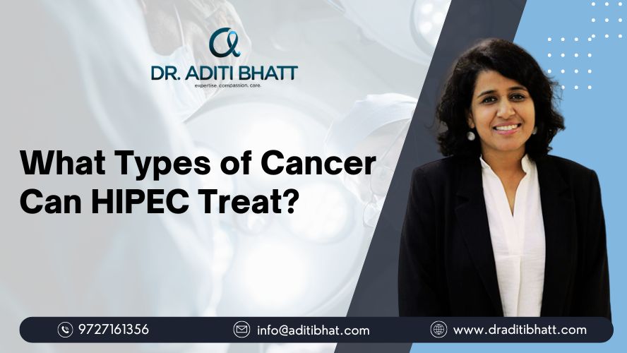 What Types of Cancer Can HIPEC Treat 