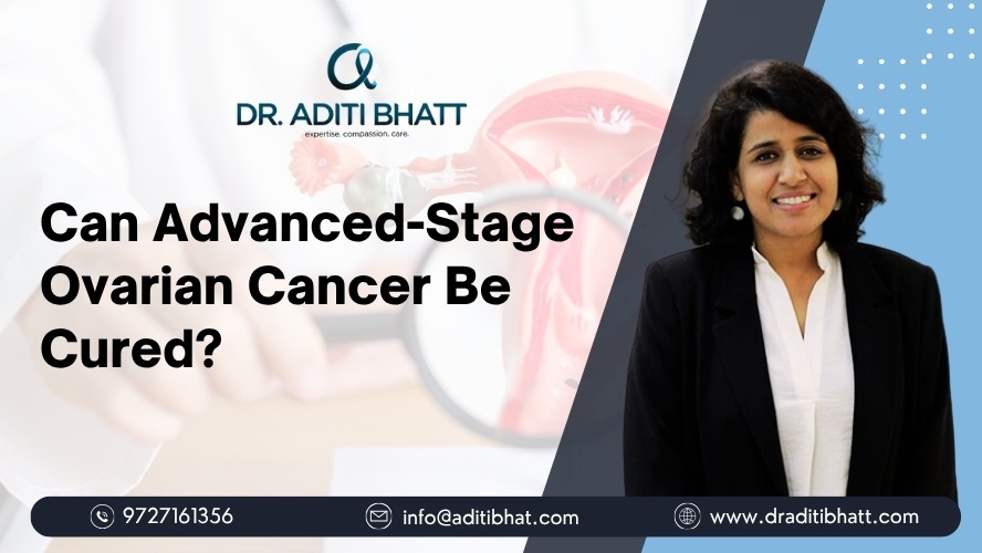 Advanced-Stage Ovarian Cancer: Can It Be Cured?